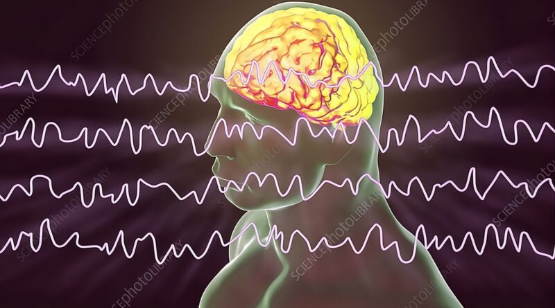 A surge of gamma waves captured in the final moments of human brain activity, showing how consciousness may persist even after the heart stops.